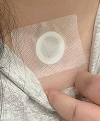 第一盘贴三伏贴,冬天请对我好一点