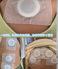 重庆市中医院宝宝三伏贴攻略