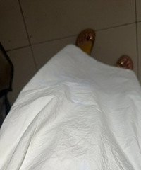 白醋+热水真是白衣服的神!白衣去黄变白洗掉了