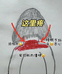 有人跟我一样,总是肩颈这里痛吗?想看看大家亲测有效的方法