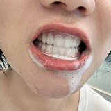 饭后立刻刷牙=毁牙?