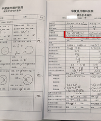 不去大坪医院也找到这个眼科专家做了近视手术,恢复得超好