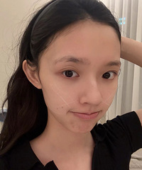 林允又分享医美项目了!有一说一,她的脸确实保养得很好