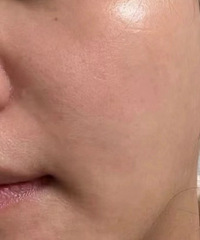 ҪëףҪƽ΢룡Ƥ仯