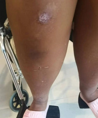 14����Ů��չӪ���巣������������6������ţ�������ʦ����