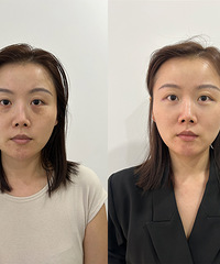 眼周抗衰真的很重要!解决了黑眼圈+泪沟+细纹,瞬间年轻5岁