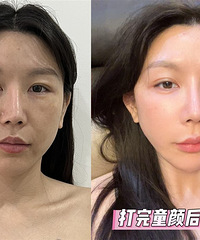“长”出胶原蛋白,才能保持年轻!这个抗衰神器,效果太明显了