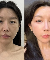 真的变年轻了!这个抗衰神器确实厉害