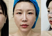 一次解决:松+垮+垂+泡,四大问题