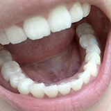 大家平时怎么保养牙齿