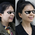 30岁也能做牙齿矫正