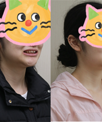 矫正牙齿还挺快,这是我8个月的变化