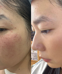 ۺߵķĺЧһξƤúܸɾ