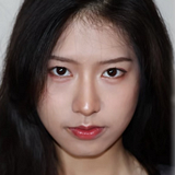 1毫升玻尿酸的改变