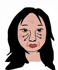 减肥减得脸都垮了,该怎么办?有经验的姐妹说说还能恢复吗