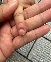 [����]С���Ѹ���һ��룬����ʳָָ�ױ��Σ���ô������