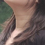 天生颈纹深该怎么改善