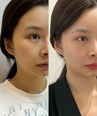 �����и����ٵ������ƺͺ���Ȧ�ķ������ָ����Ч��̫������