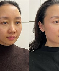 ���ٿ����Ŀ�˥��Ŀ��ë��С��Ƥ������