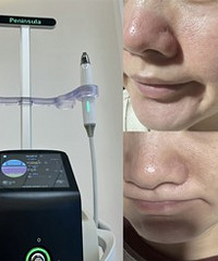 ë�״ִ󻹷����Ƥ�����������