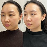 Ƥ������ë�׻�ϸ����