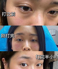 [����]�ṵ+ϸ��+����Ȧ����ѡ��2��������Ŀ������Ч�����