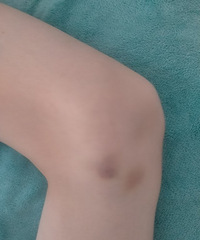 ����8�껹���򴲣�������Ա�֢�����ƴ�����û��