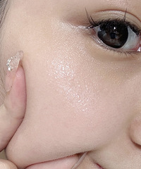 [����]�ɿں�Ƥ����������ҽ��Ǻ󶻶�ȫ��ʧ��