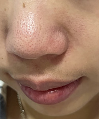 ��ͷ�ϵ�ë�״��Ա����������˻ƽ�΢��