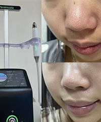 ��ͷ�ϵľ޴�ë�ף����ڸ�����