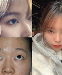 ����˫��Ƥ����ȫ������˸���