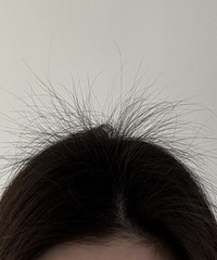 [����]˵˵�����ܳ���ͷ���ķ�������ͷ���ڶ�ˮ��ͷƤ����