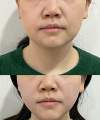 ������ȥ�������˥����Ŀ����һ�ξ������˺ö�