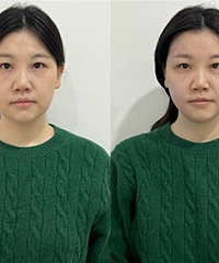 ��ǰ�������˥��Ŀ����������������