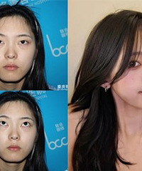 ���������۴����ָ�2���º�ı仯