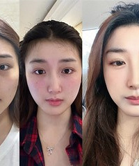 ��ױ�ڲ��˵ĺ���Ȧ�����������������