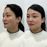 �������������ʹ����