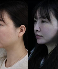 �沿�����������޸�����ʹ���ָ���