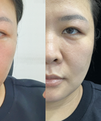 �����ṵ�ͺ���Ȧ�����ܼ��ȷ���