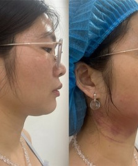 �ײⲻ���ף�˫�°�û�ˣ������������