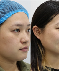 �ײ���Ч��������������������ϸ��