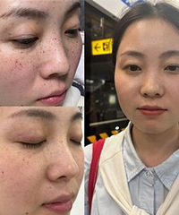 ���ֵ�����������Ч��Ƥ���׾��˺ö�