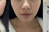 �ƽ�΢�������Ч���ҵĺ�����ʹ�ë�׶�������