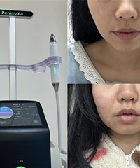 �������Ŀ��������ʹ�ë�׶��ܸ���