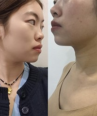 �ײⲻ���ף���¼����ƵĻָ�����