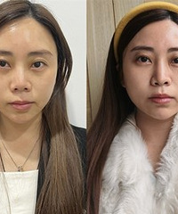 ���ƺ���Ȧ+�ṵ��˲���������