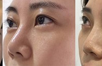 �������ữ�ܼ򵥣����ƺ���Ȧ+�ṵ����ӯ�Բ�