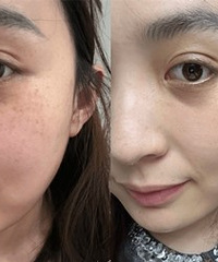 �����ʵ���ܣ�������ʹ��Ч���ͻָ�