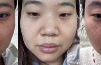 ���һ�꣬���ڸ����ϵİ�˵�ټ���Ƥ���ɾ��ö�