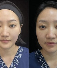 ���Ļ���Ҫ���Կ�˥��Ŀ��������ͱ���